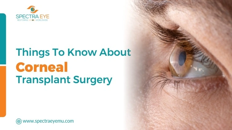 Things To Know About Corneal Transplant Surgery
