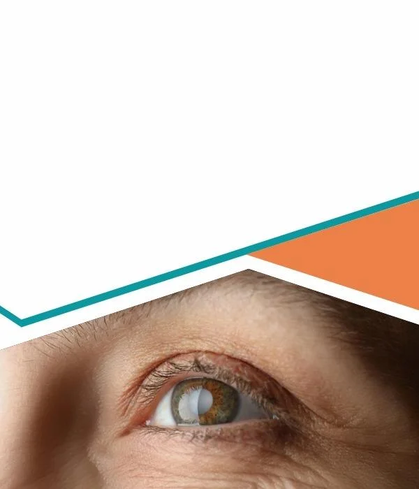 Cataract Surgery In Mauritius